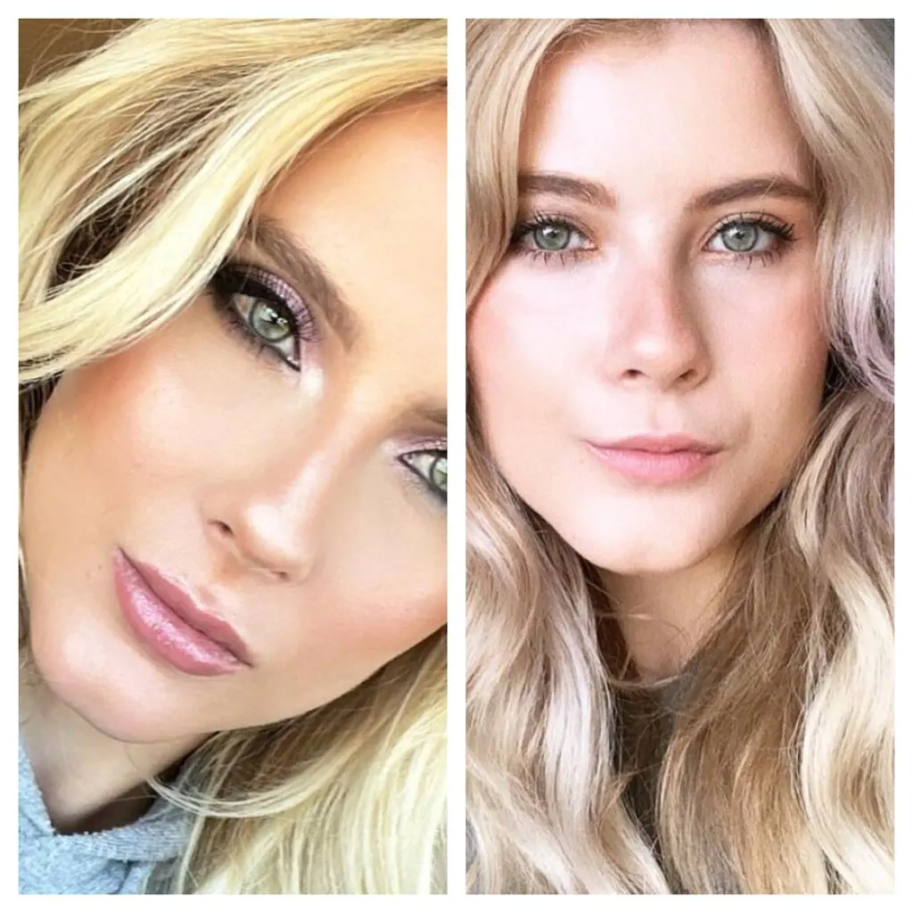 Alexandra Rose's before and after pictures shows some changes on her chin
