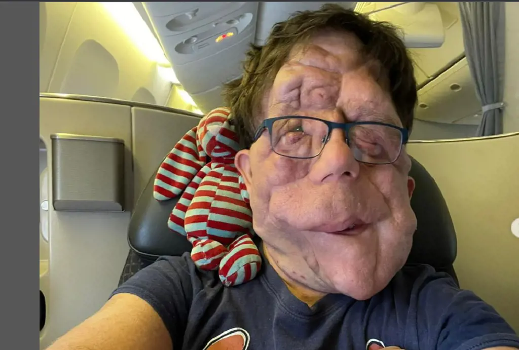 Adam Pearson Flying To New York