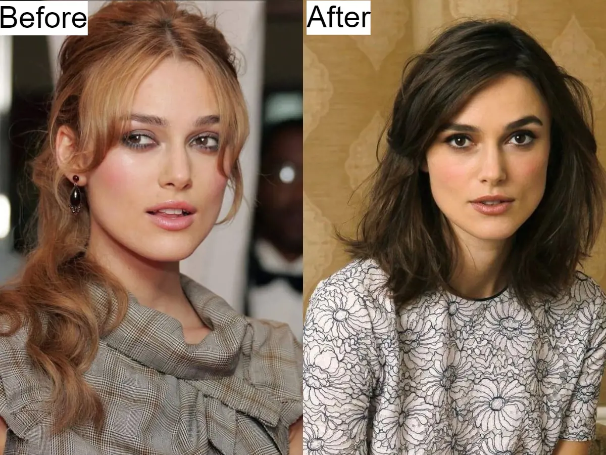 The extent of Kiera Knightly hair loss forced her to wear wigs for five years.